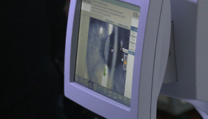 В офтальмологической больнице - новый диагностический аппарат