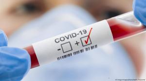   У 11 человек в Хакасии подтверждён COVID-19