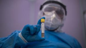 COVID-19: за сутки излечившихся стало на 28 больше