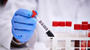 За минувшие сутки число выздоровевших от коронавируса в Хакасии превысило количество заболевших