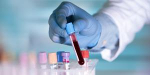 В Хакасии зафиксирован новый максимум числа зараженных коронавирусом