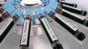 Заболеваемость коронавирусом в республике снижается