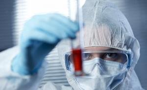 За выходные количество умерших от коронавируса увеличилось до 399