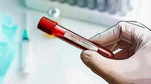 Смертность в Хакасии из-за COVID-19 растет