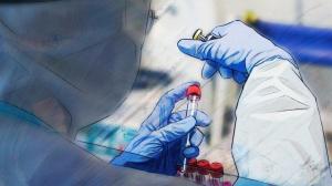 Количество летальных случаев связанных с коронавирусом вновь увеличилось  