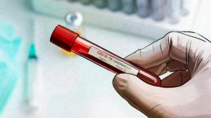 Уровень заболеваемости коронавирусом в Хакасии почти вдвое выше, чем в среднем по России