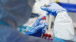 Ещё 5 пациентов с коронавирусом скончались за выходные в Хакасии